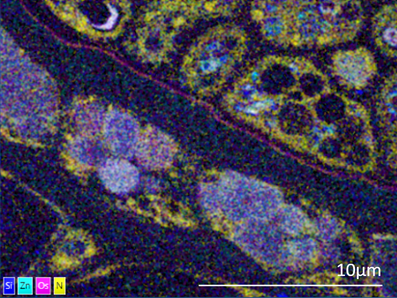 Venus’ fly trap leaves and glands imaged with the Ultim Extreme detector at 5kV