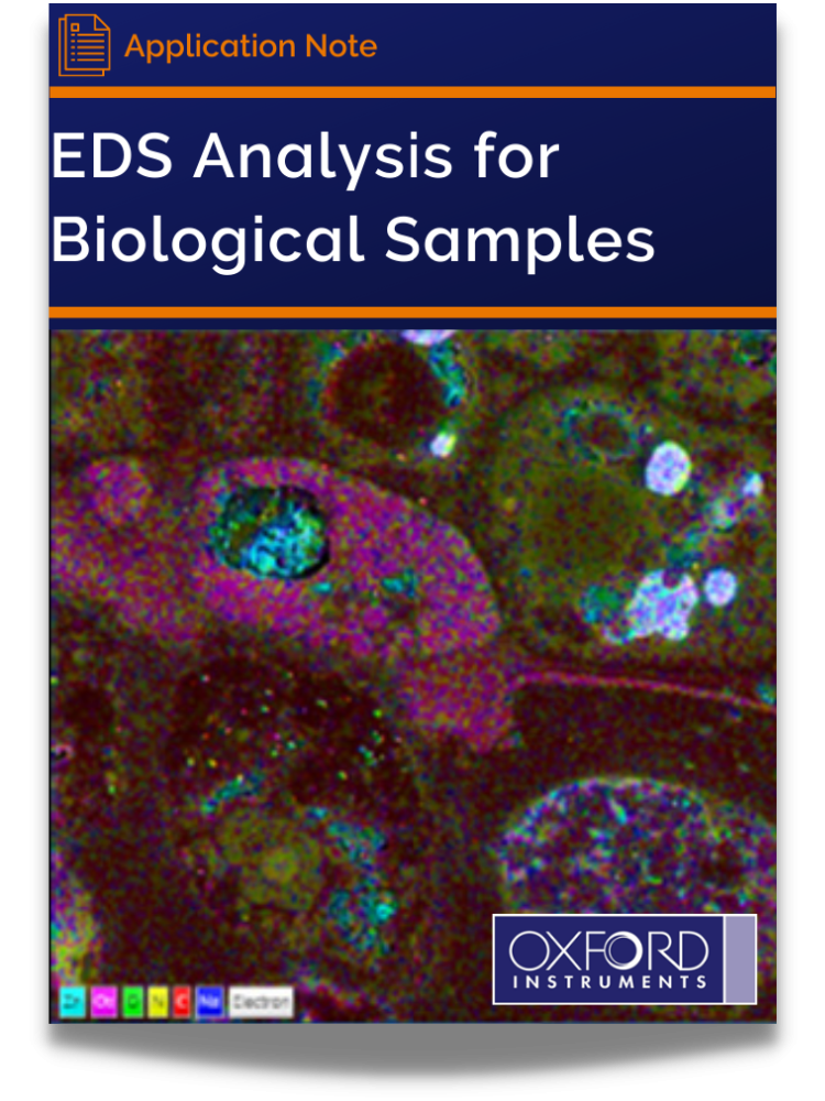 EDS Analysis for Biological Samples