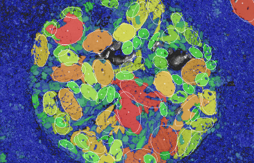 碳质球粒陨石中球粒的晶粒尺寸分布图